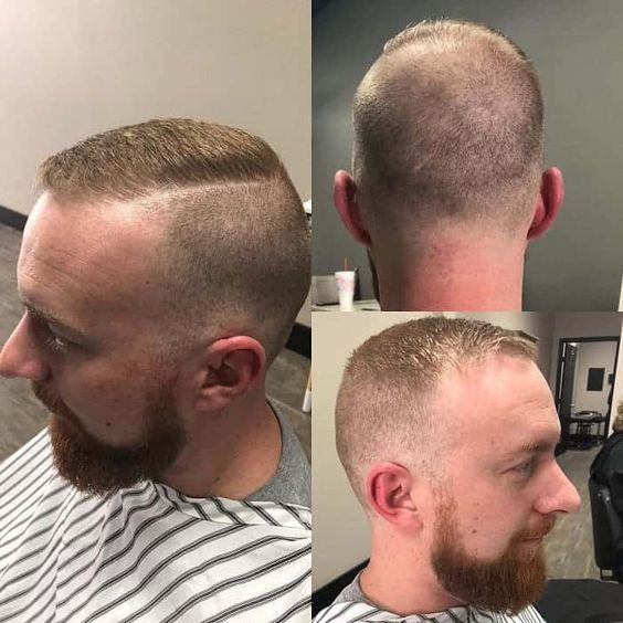 12 Best Haircuts For Balding Men